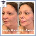 Pic5